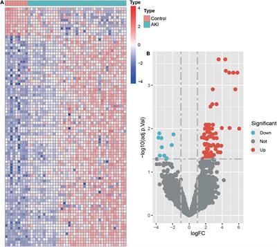 Machine learning algorithm-based identification and verification of characteristic genes in acute kidney injury